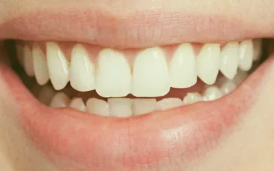 ¿Sabías que hay quien tiene menos dientes de lo normal?